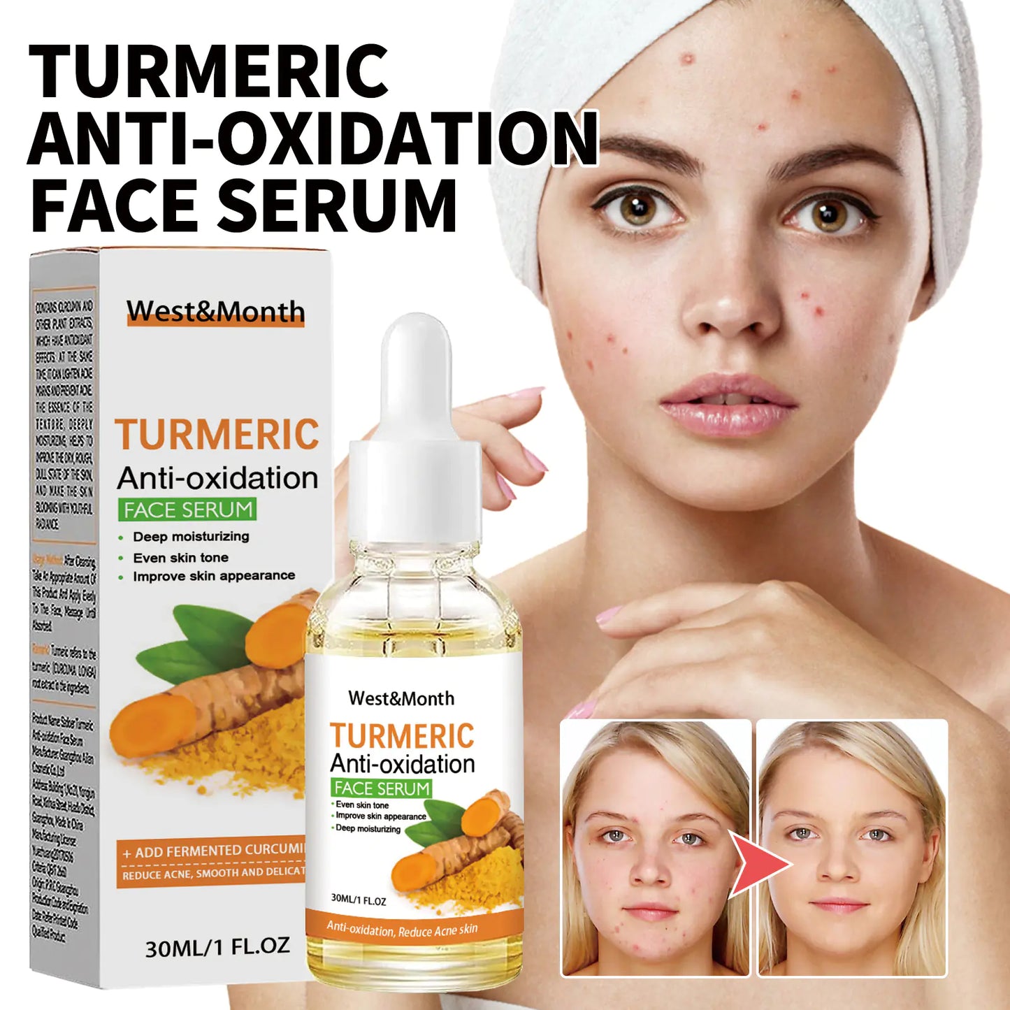 Turmeric Anti-Oxidation Face Serum – Glowing Skin Formula by West&Month for Hydration and Brightening
